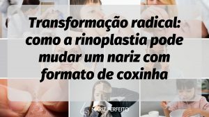 Transformação radical: como a rinoplastia pode mudar um nariz com formato de coxinha