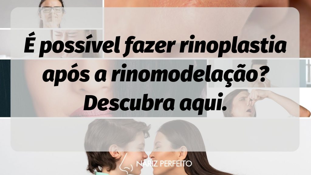 É possível fazer rinoplastia após a rinomodelação? Descubra aqui.